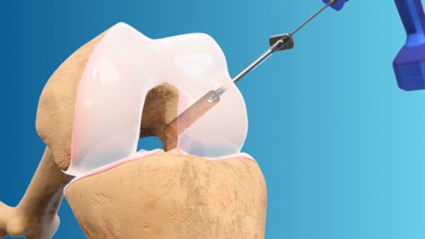 FlexDrill Broca Retrógrada - Image 4