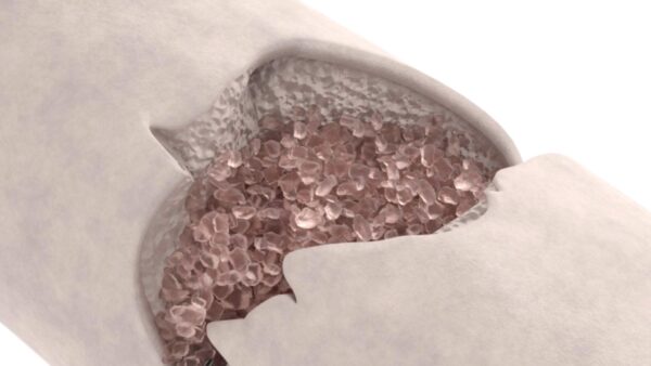 Singlass biovidro - Image 3