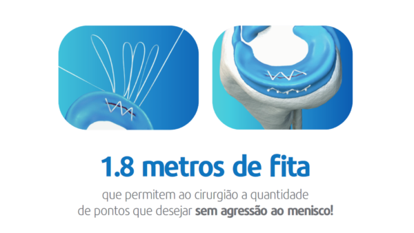 Meniscus 4All - Image 3