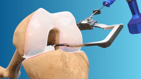 FlexDrill Broca Retrógrada - Image 5