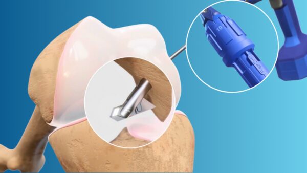 FlexDrill Broca Retrógrada - Image 3