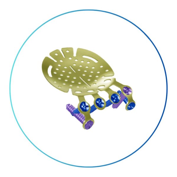 Sistema Delta Micro placas 1.2