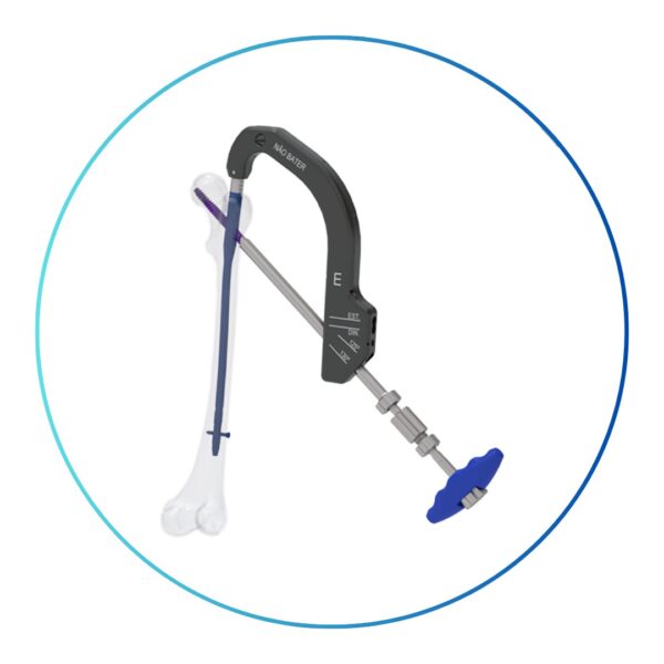 Sistema de Haste Trocantérica Femoral ZETA