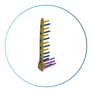 Sistema de Placas GAMA Femoral Distal