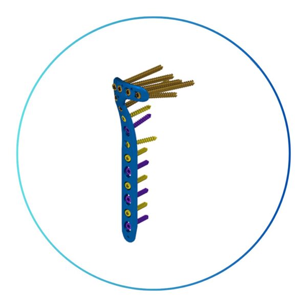 Sistema de Placas GAMA Tibial Proximal