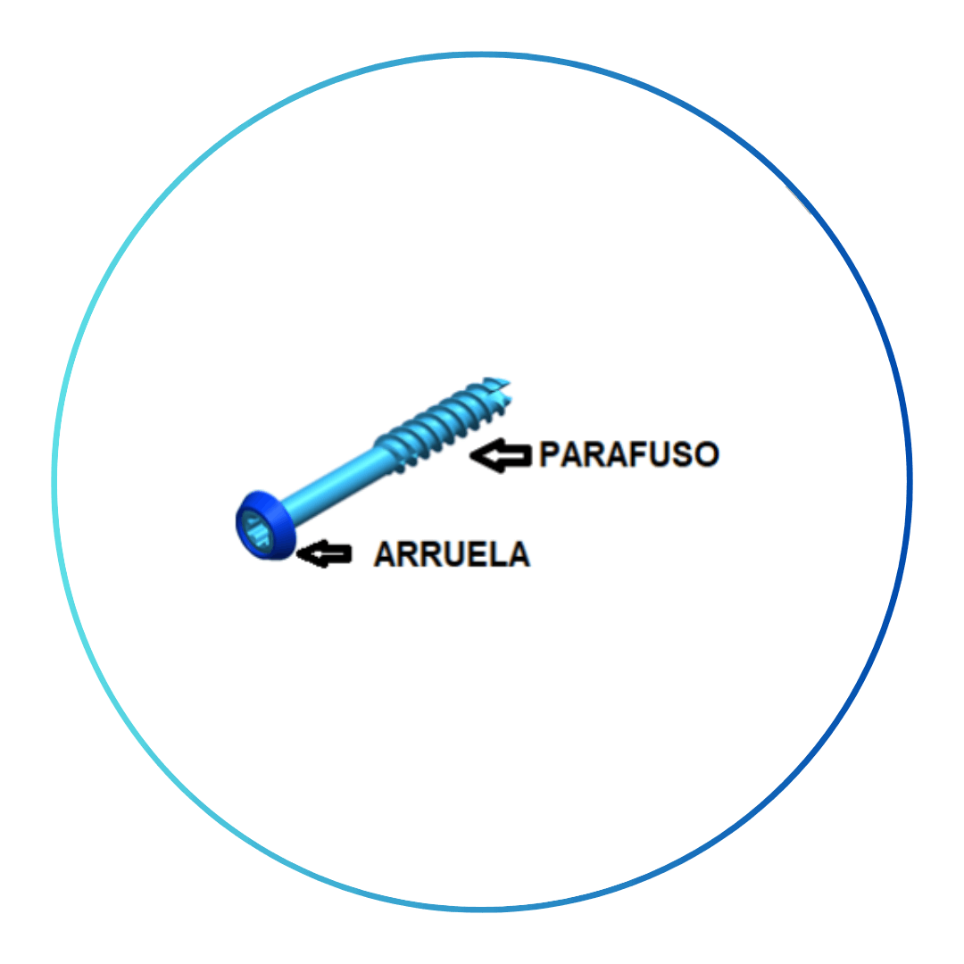 Parafuso Canulado com Arruela - MEFIX